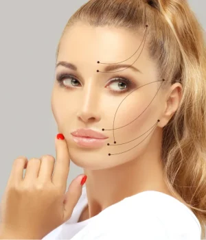 Cat Eyes Estetik Ameliyatı (Kantoplasti) Kedi Gözü Estetiği İstanbul